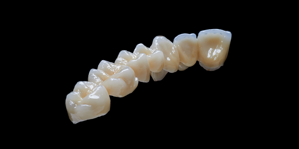 Individuelle Abutments