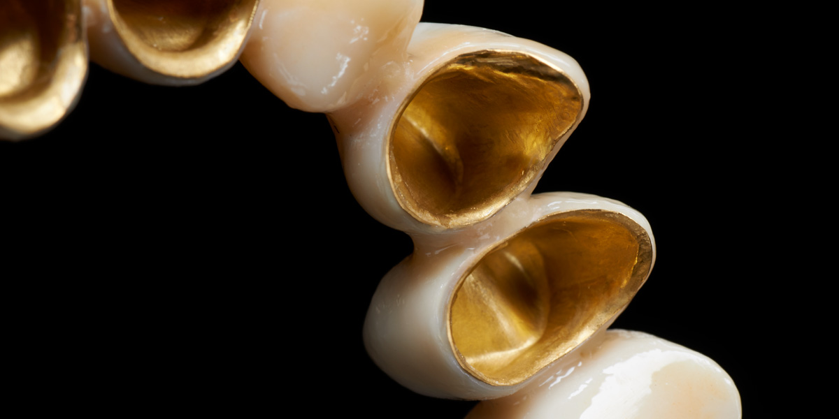 Keramische Versorgung