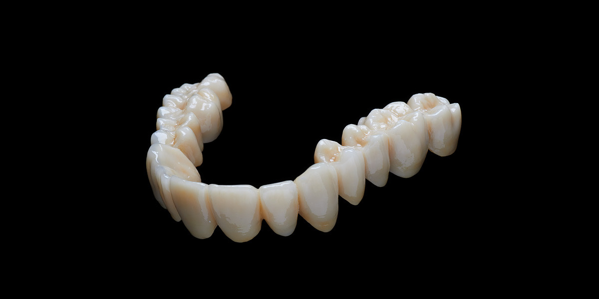 Totalprothese ästhetisch