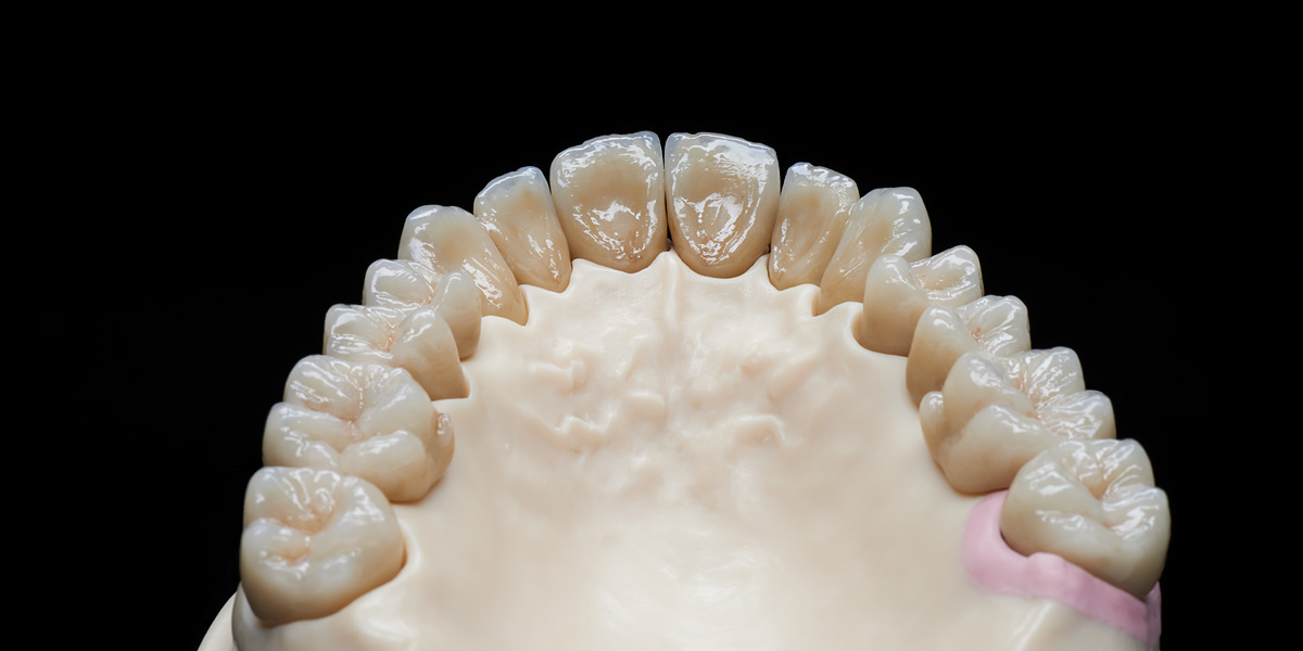 Teleskopsystem Zirkon