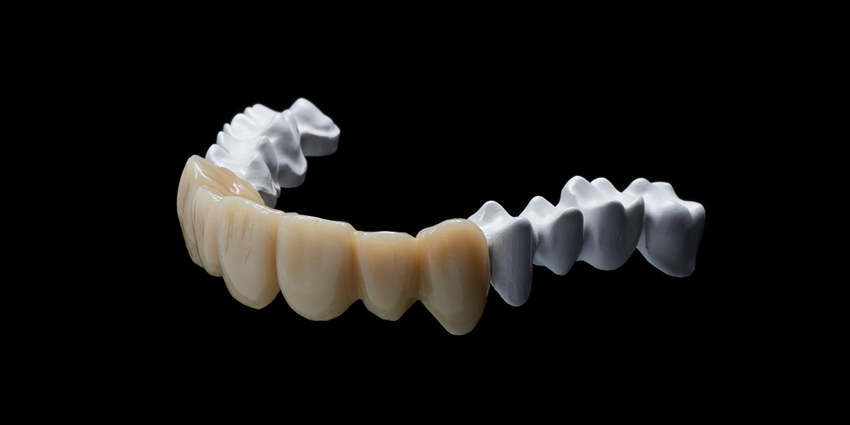 Teleskopprothese Titan