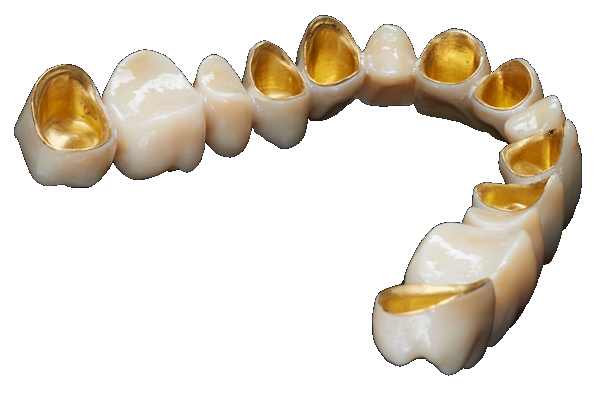 Zirkon Galvano Teleskopprothese