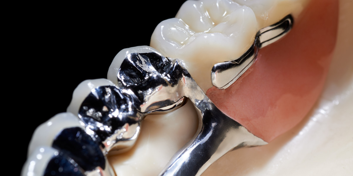 Präzise Implantologie